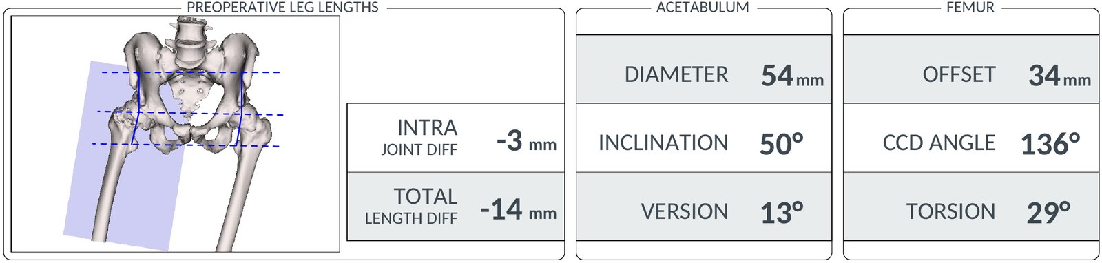 Bilan 3D du bassin et des fémurs : écart de longueur des jambes, mesures du cotyle et du fémur